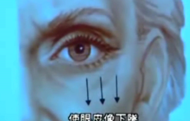 射频紧肤令骨胶原重生