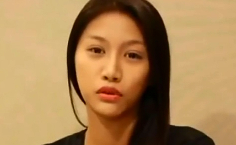 玻尿酸隆鼻-混血美鼻