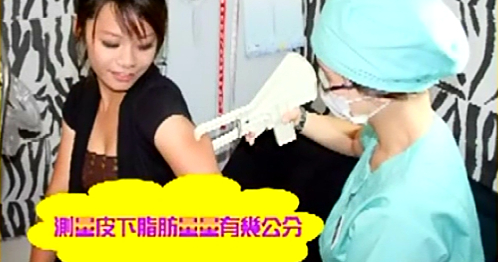 雷射溶脂瘦手臂经验分享