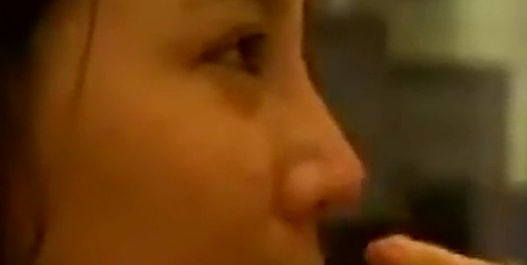 注射隆鼻—五点美鼻法