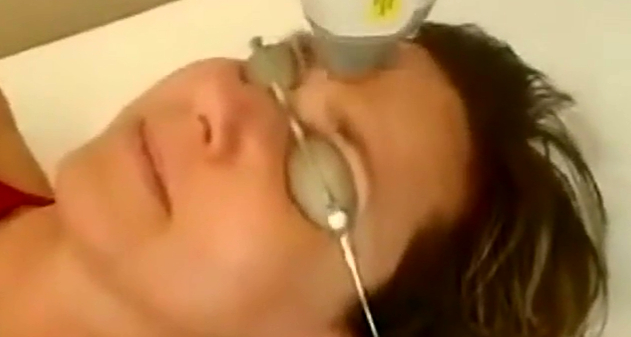 激光祛斑到底是怎样的