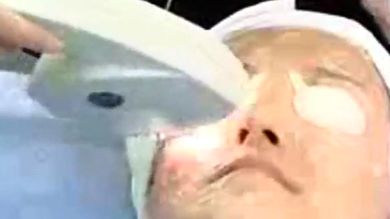 美容医学 紧肤 嫩肤