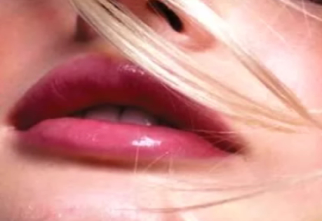 爱贝芙注射丰唇后效果展示