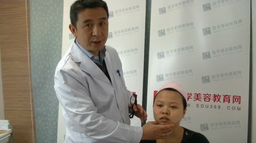 朱灿现场隆下巴-画点