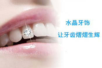 水晶牙饰 让牙齿熠熠生辉