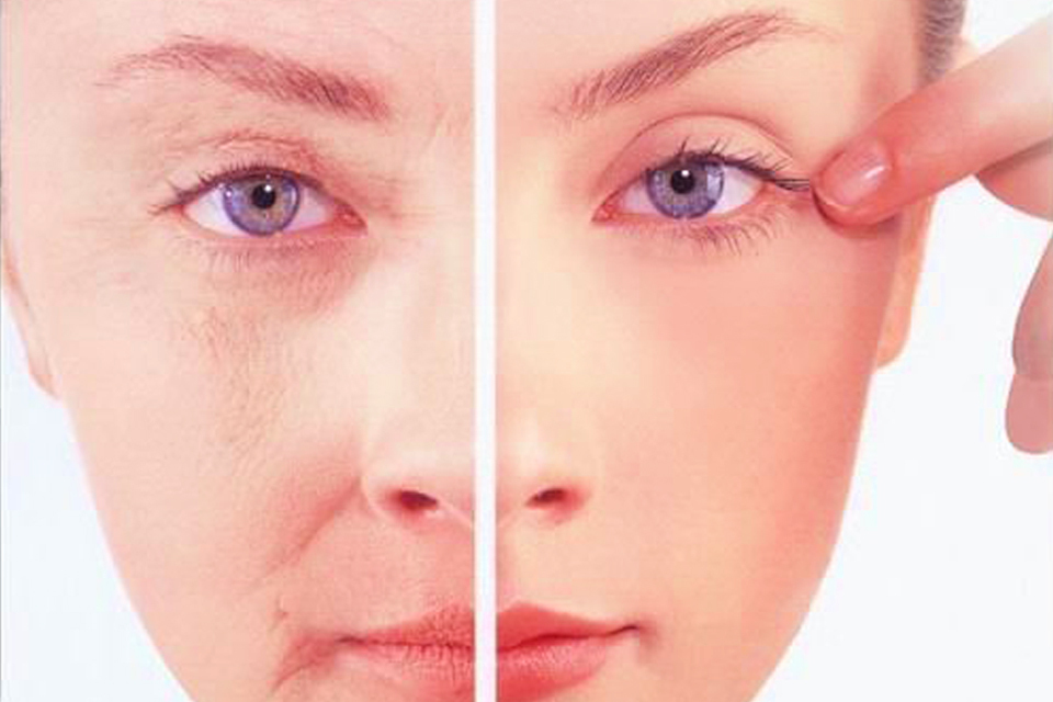 多项技术综合治疗面部衰老