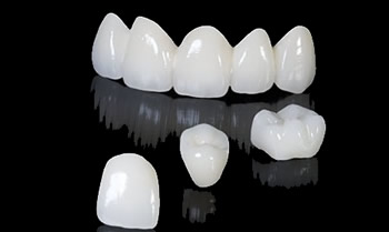 烤瓷牙的适应症与优势