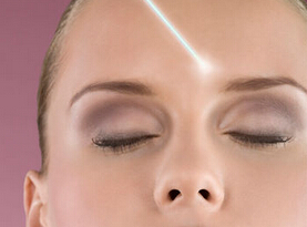  激光除皱的原理及特点分析