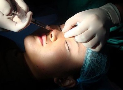 微整形常见项目主要有哪些