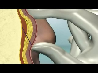 韩式4D无痕拉皮