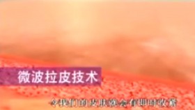 微波拉皮紧肤技术