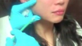 微整形教主肉毒杆菌