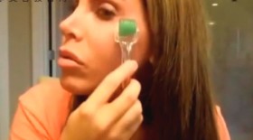 微针美白术治疗你的皮肤