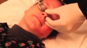 微针美白除皱抗衰老