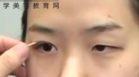 韩国最新双眼皮手术