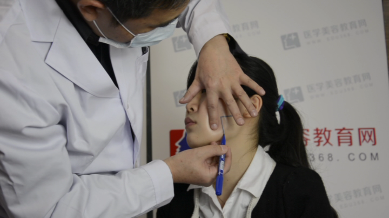 对瘦脸画点的分析