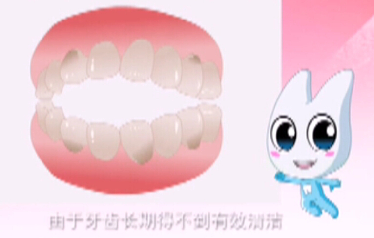 亮白牙齿-告别黄牙