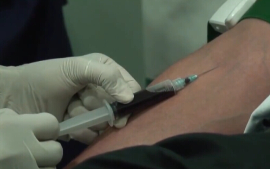 通过PRP治疗去除眼部黑眼圈