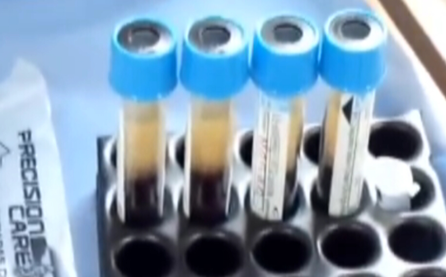 PRP技术运用的全面讲解