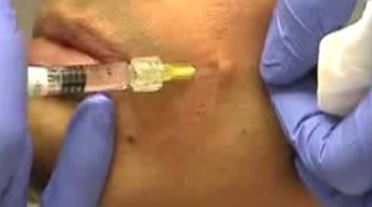 面部微雕技术学习