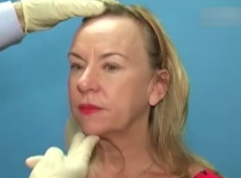 全脸综合注射美容