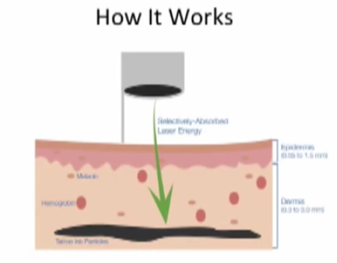 去纹身前应该知道的几件事