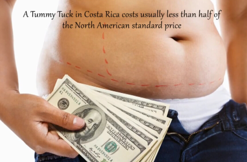 腹部吸脂减肥手术要点讲解