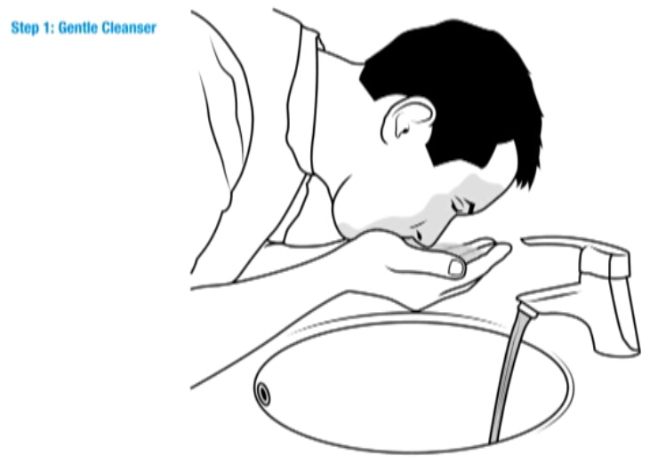 痤疮的日常护理和治疗