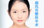扇风耳整形的手术方法步骤