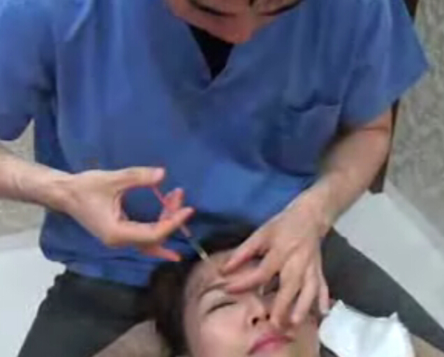 点状注射去除抬头纹