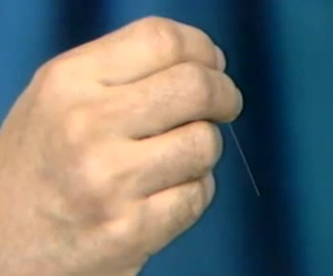 针灸进针方法一