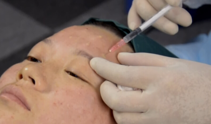 细胞修复因子点状注射