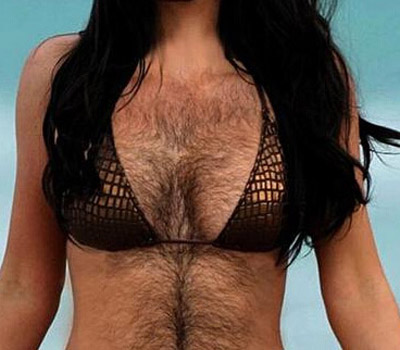 一女子丰胸未成功反而长黑毛