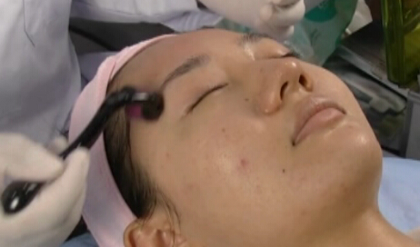 干细胞种植因子治疗