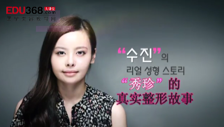 韩国“秀珍”真实的整形故事