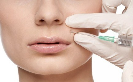 肉毒毒素微滴注射技术操作流程