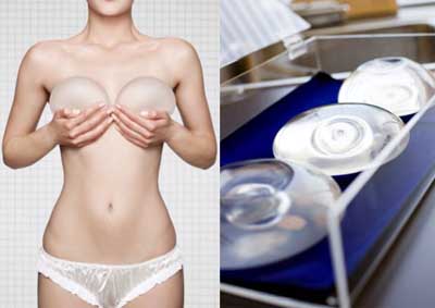 安全隆胸之假体隆胸利弊谈