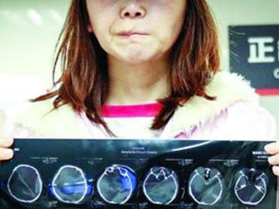 一女子赴韩整形失败维权却被关进看守所