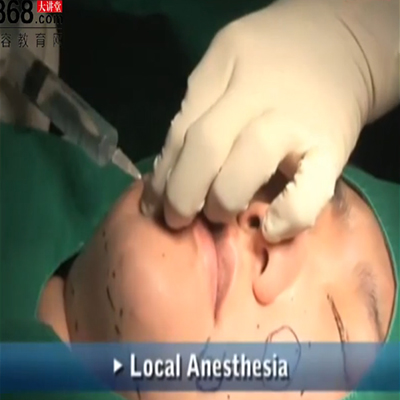 整形外科手术：脸部抽脂