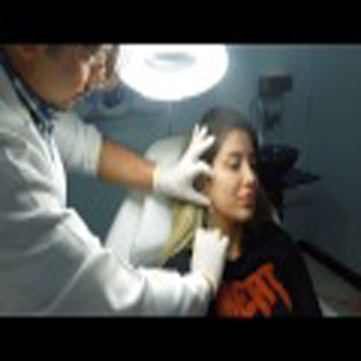 肉毒杆菌填充轮廓线瘦脸提升