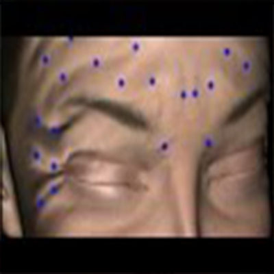 3D演示消除面部皱纹