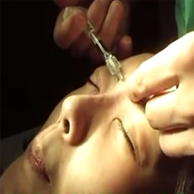 玻尿酸注射多方位护理