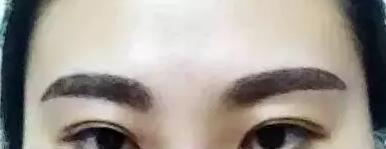 纹眉发炎了怎么办