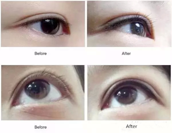 半永久妆颜术为什么会这么受欢迎