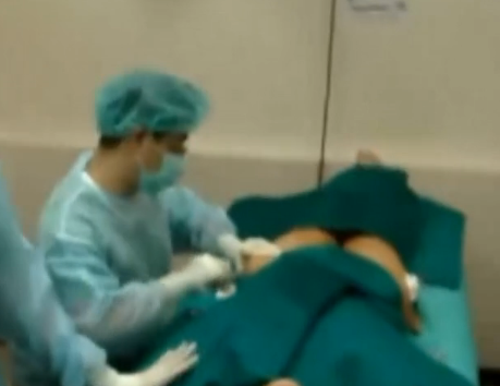 脂肪移植腿部抽脂