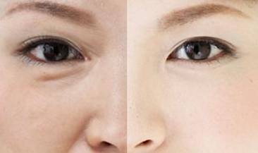 想挽留将逝的青春,怎么办?