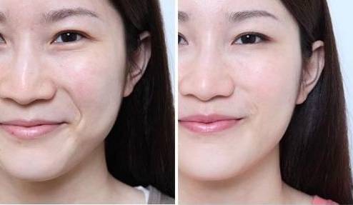 想挽留将逝的青春,怎么办?